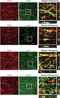 Casein Kinase 2 Signaling in White Matter Stroke